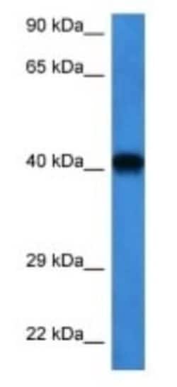 FFAR2/GPR43 Rabbit anti-Human, Polyclonal, Novus Biologicals 100 &mu;g | Buy Online | Novus Biologicals | Fisher Scientific